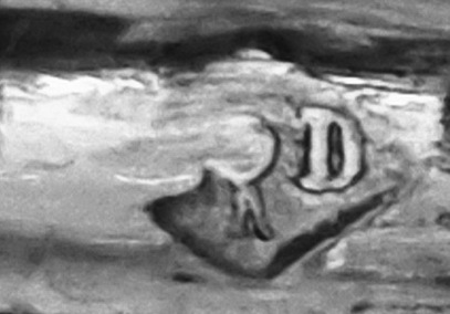 MZ FR _ Symbol D.jpg