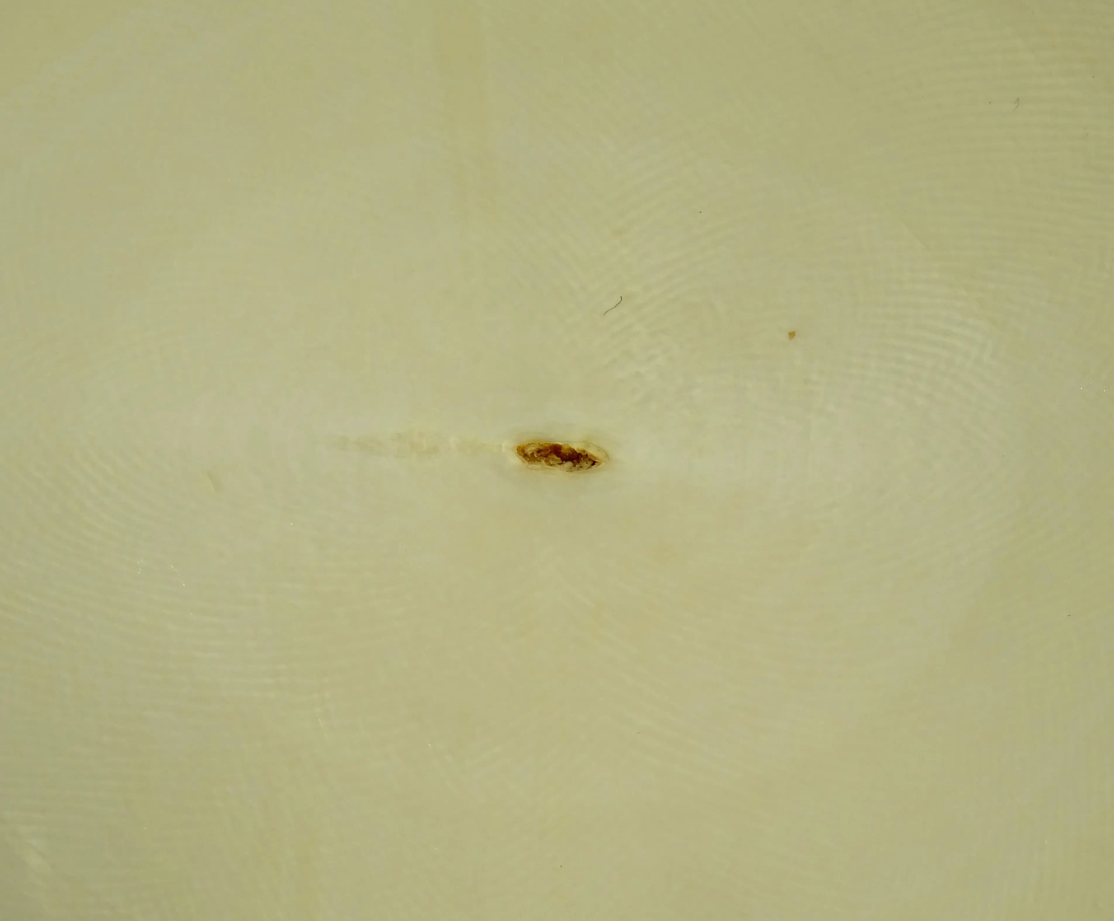 Schmelz - Pulpa (5).webp